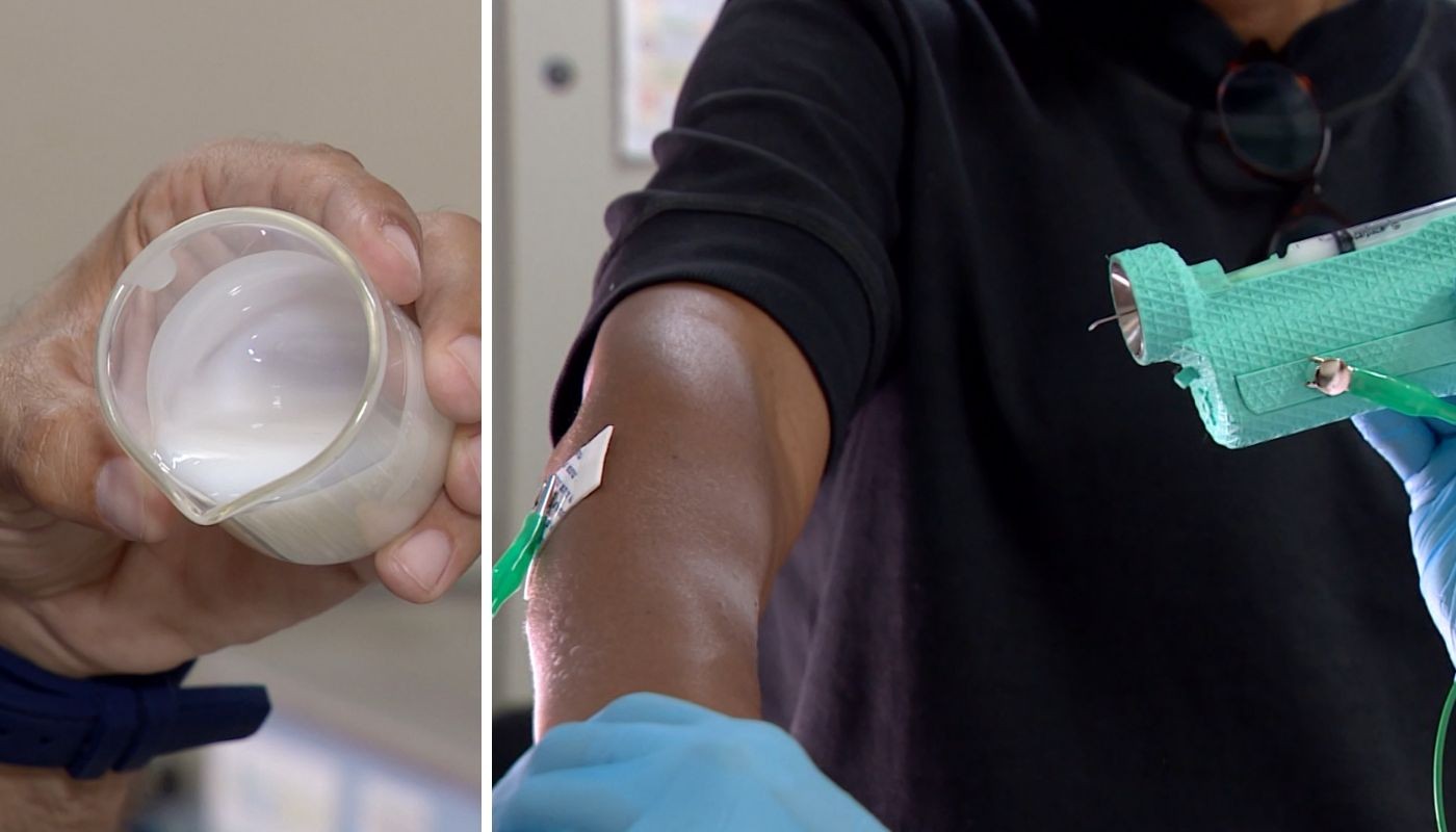 Pesquisadores da Unicamp criam curativo líquido biodegradável a partir da cana-de-açúcar para substituir ataduras e reduzir resíduos