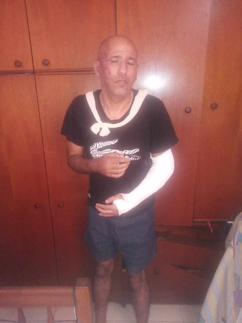 Renato Medeiros, com braço enfaixado e ferimentos no rosto, em 2023, quando denunciou seu ex-chefe, o MC Poze do Rodo — Foto: Reprodução