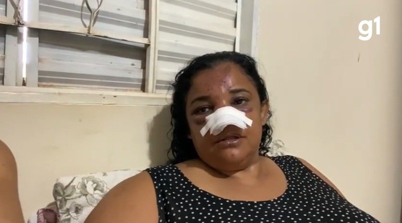 Mulher que sofreu queda durante trilha em morro recebe alta em MT 