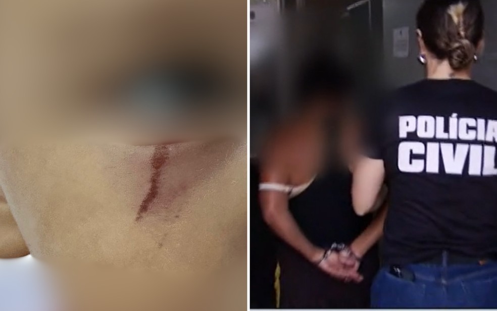 Criança de 1 ano é encontrada com lesão no rosto no momento em que mãe era presa por torturar a outra filha de 3 anos — Foto: Divulgação/Polícia Civil e Reprodução/TV Anhanguera