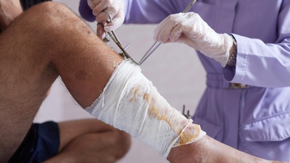 Ambulatório de Feridas da Unimed Cuiabá devolve qualidade de vida a pacientes