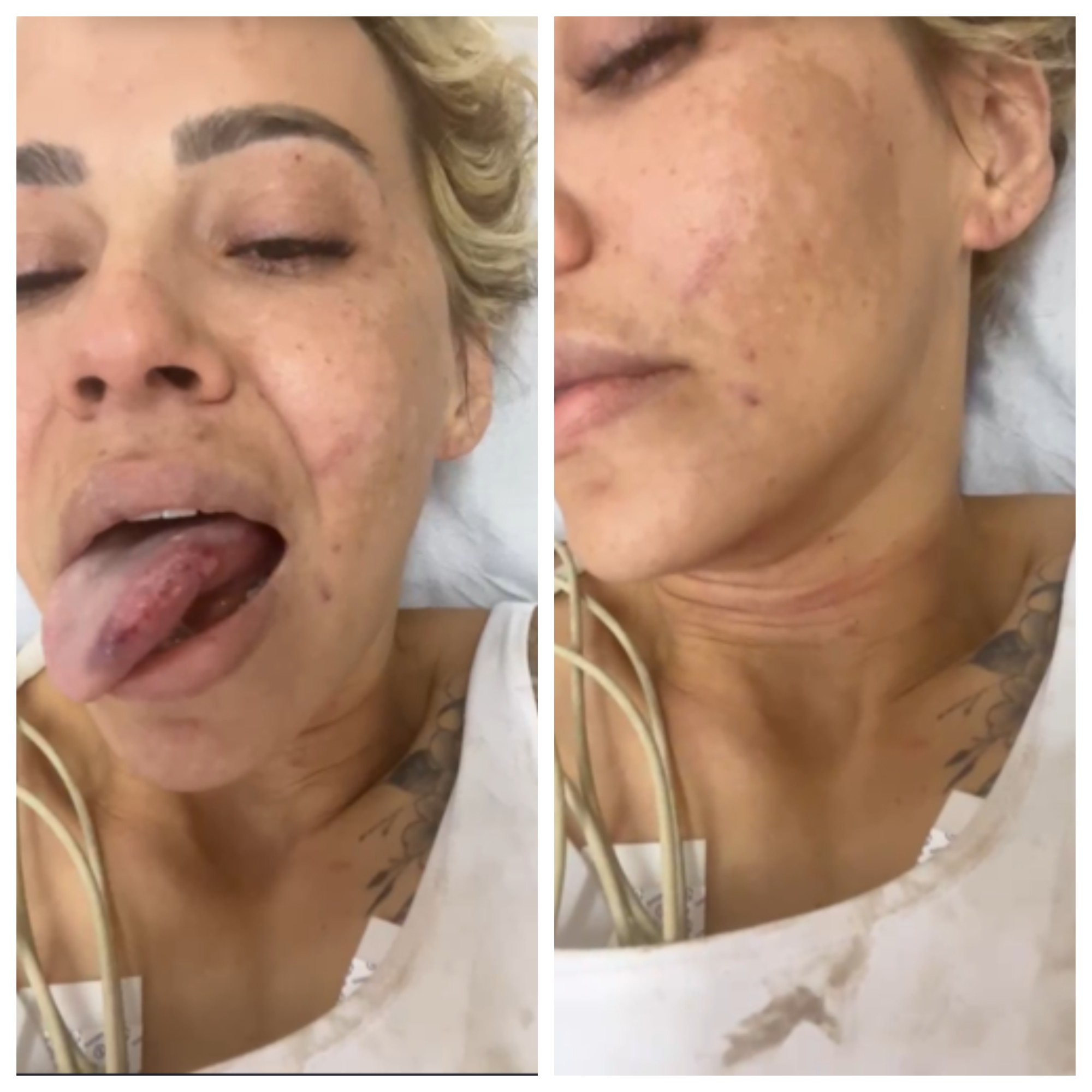 'Ele me enforcou tanto que me desmaiou duas vezes', diz mulher espancada pelo ex-noivo em BH; VÍDEO