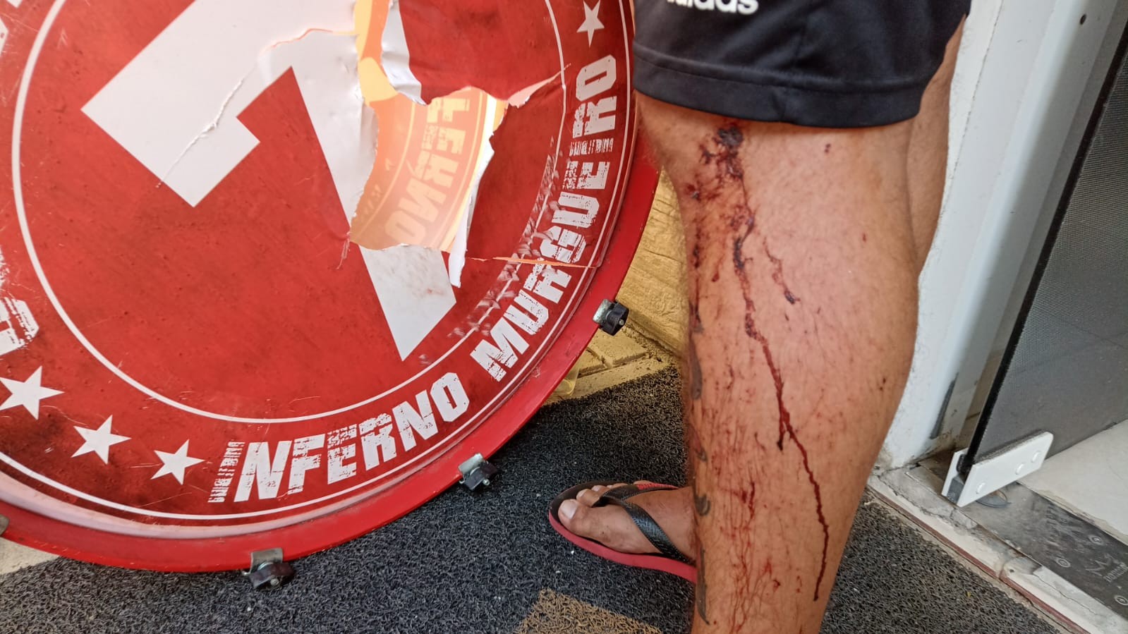 'Temi pela minha vida': torcedor do Internacional relata tensão e medo durante briga entre torcidas em SC 