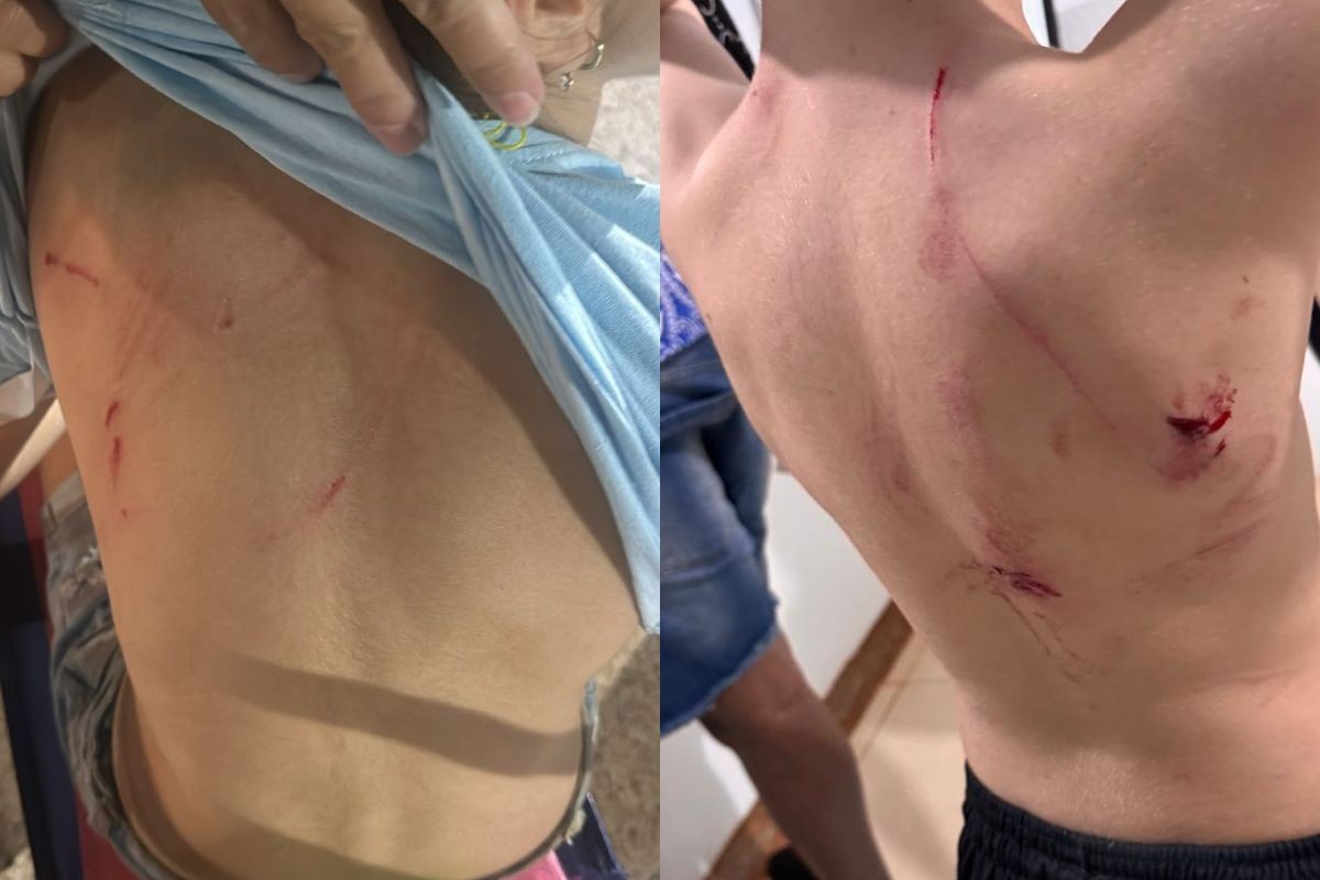 Cão da raça rottweiler é capturado após atacar crianças em praça de MT