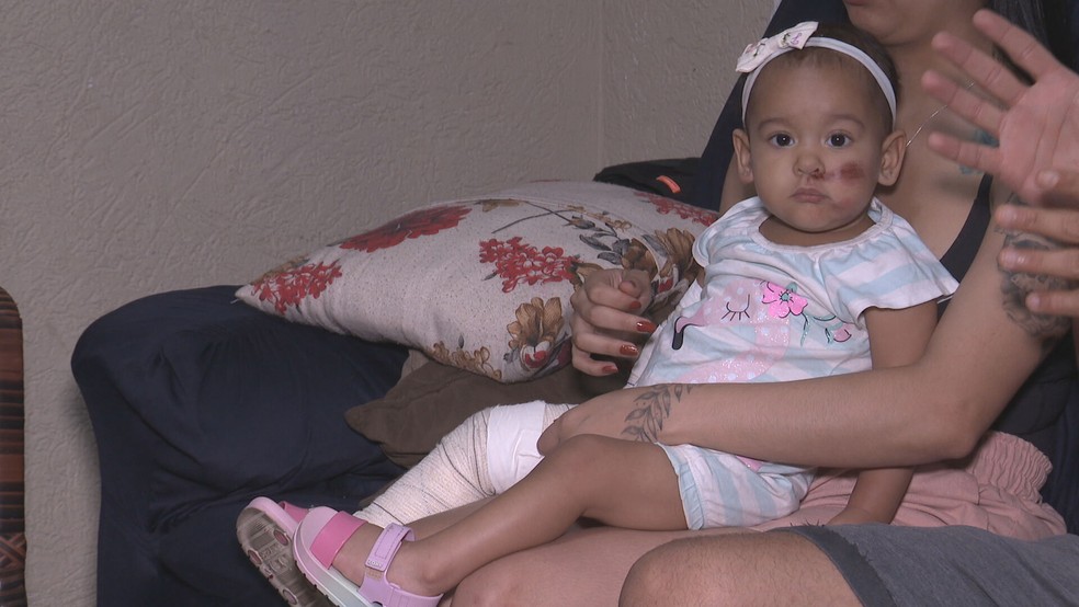 Raabe, de 1 ano e 5 meses, ficou ferida após ser atropelada pelo carro do pai, no DF — Foto: TV Globo/Reprodução