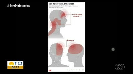 Bom Dia Responde tira dúvidas sobre enxaqueca