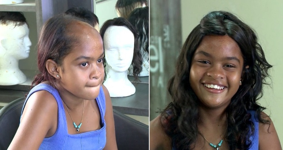 A adolescente recebeu a doação da prótese de um cabeleireiro, que se sensibilizou com a história da garotinha — Foto: TV Clube