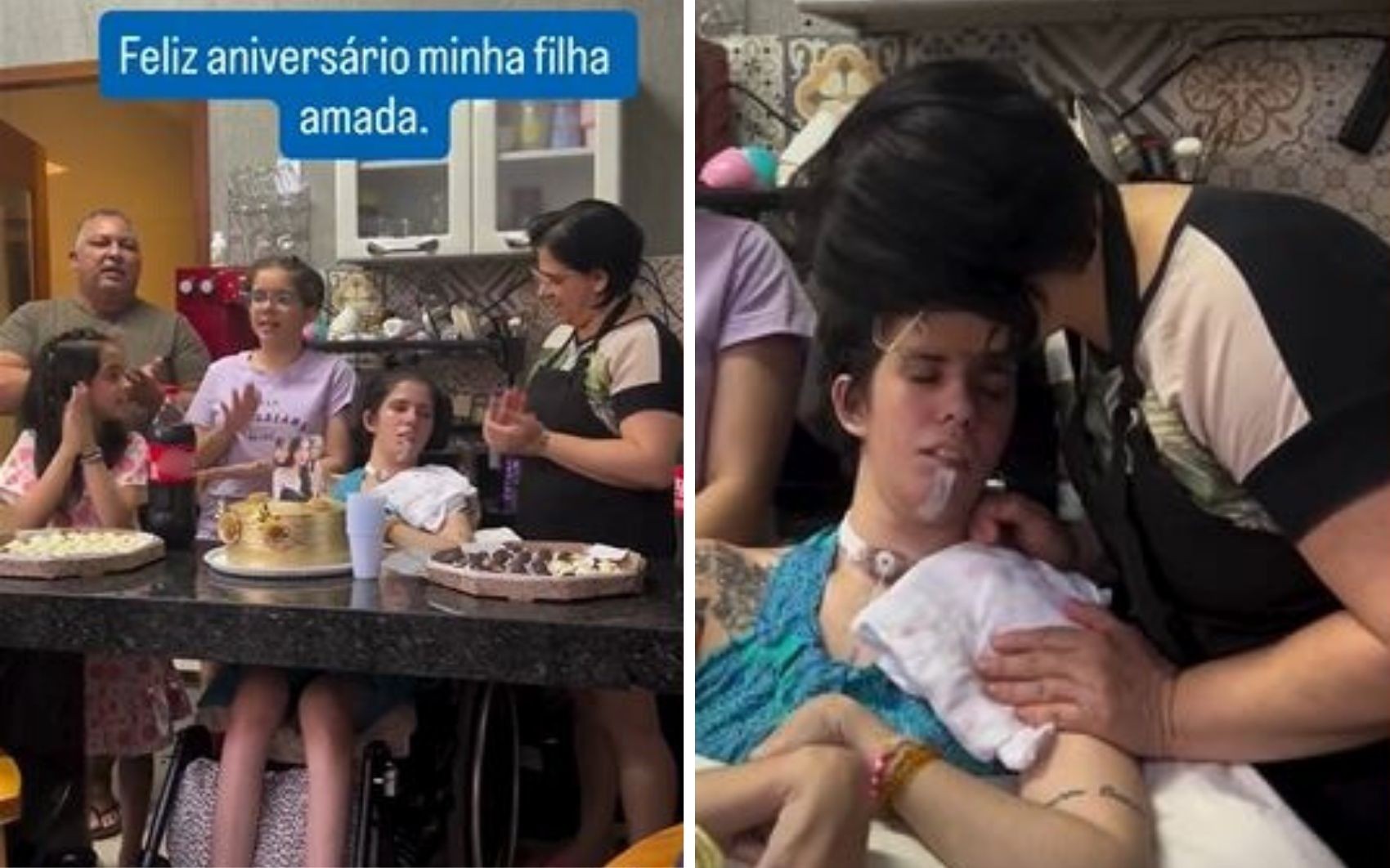 Jovem que teve reação grave após cheirar pimenta faz aniversário, e mãe desabafa: 'Mais um ano de batalha'; vídeo
