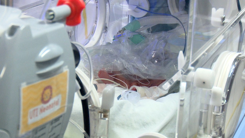 Maternidade da capital atende 11 pacientes prematuros atualmente — Foto: Reprodução/Rede Amazônica Acre