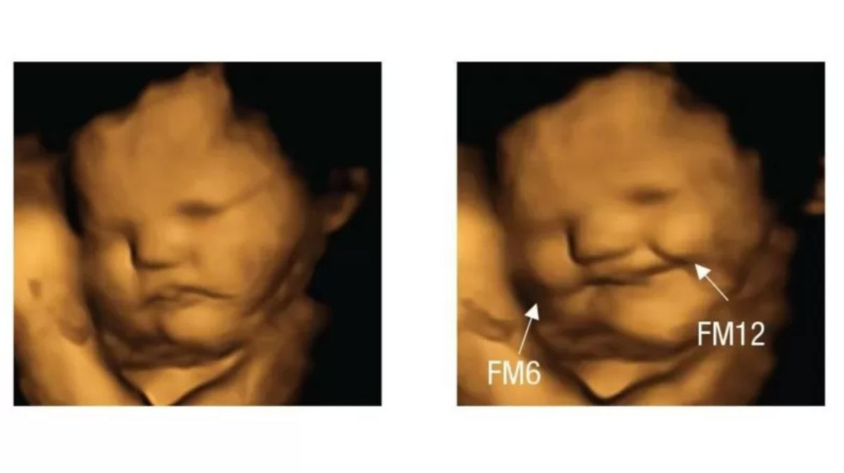 Bebês no útero 'sorriem' para cenouras e 'fazem careta' para couve, dizem  cientistas