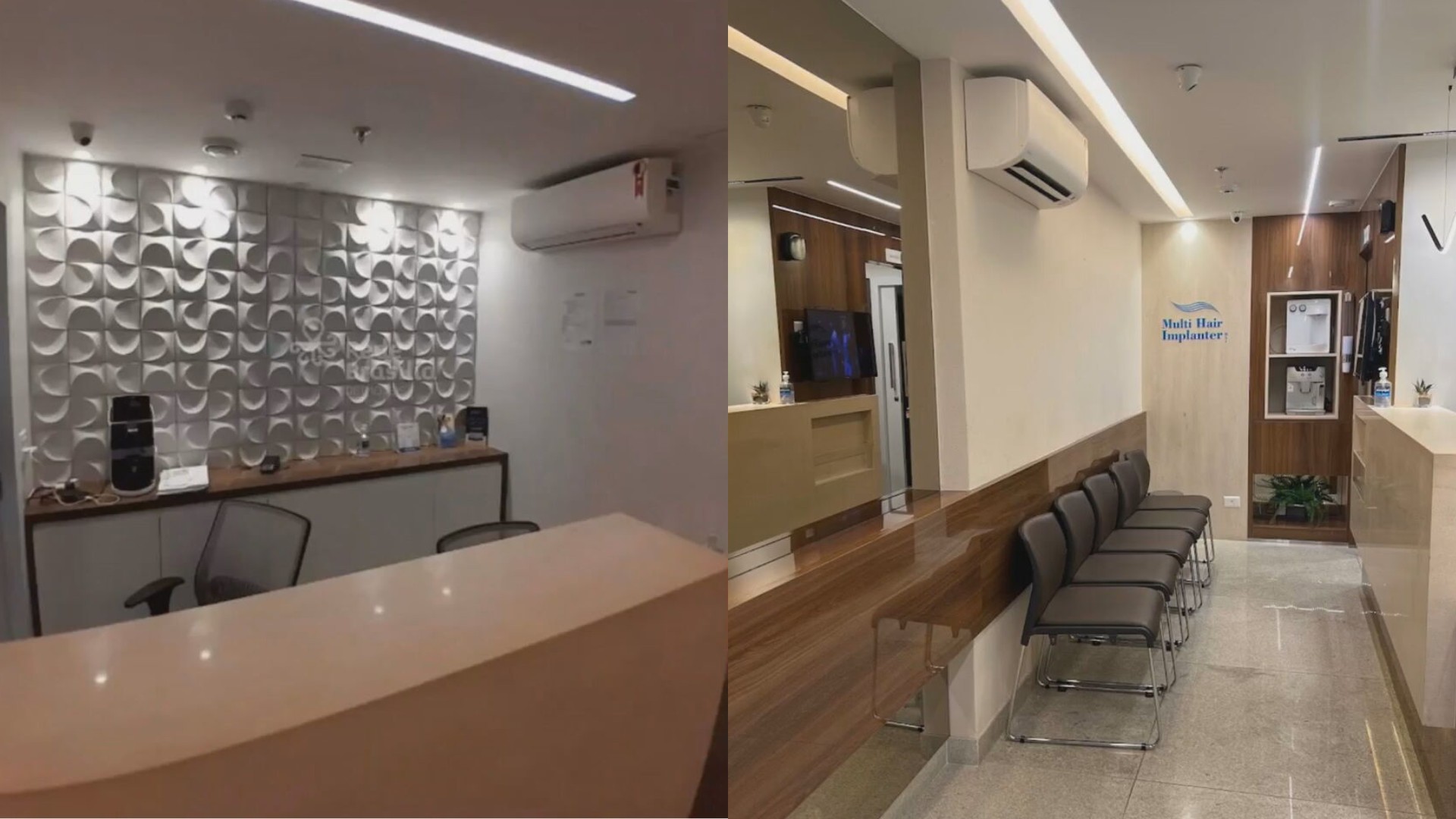 Transplante capilar: clínica de Brasília é acusada de dar calote em ex-funcionários e clientes