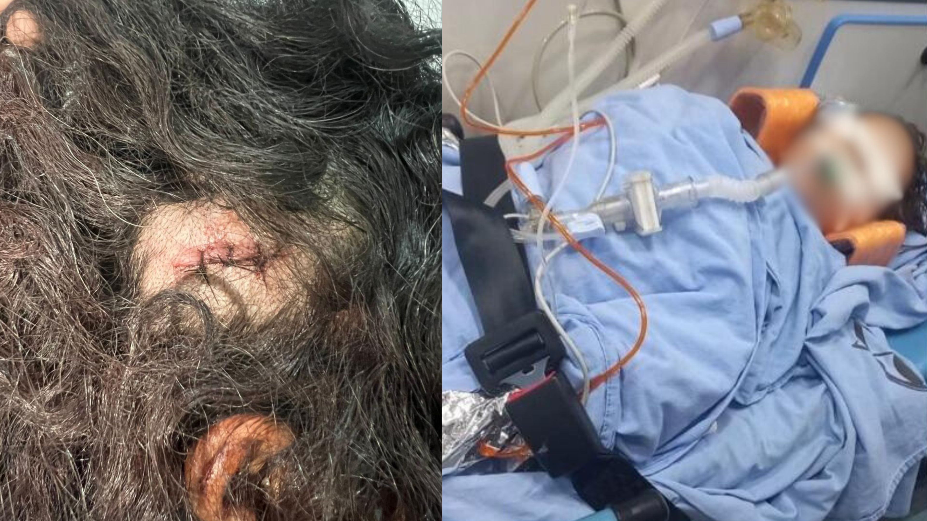 Homem é preso suspeito de tentar matar enteado de 3 anos após discutir com esposa em RO