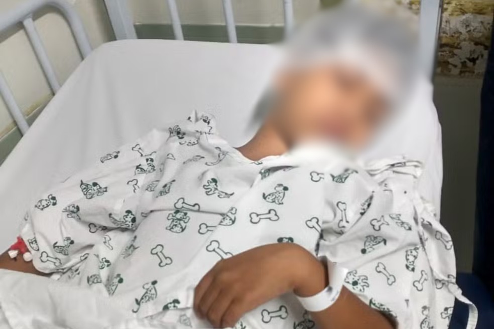 Criança, de sete anos, precisou passar por cirurgia e ficar três dias internada em Praia Grande, SP — Foto: Arquivo pessoal