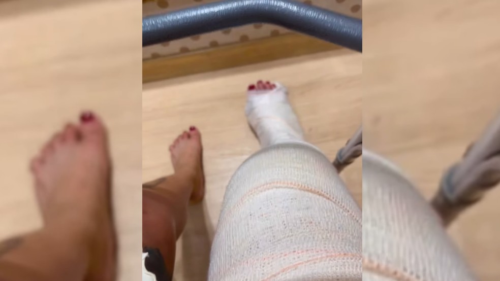 Mulher foi baleada na perna em Rio Preto (SP) — Foto: Reprodução/Instagram