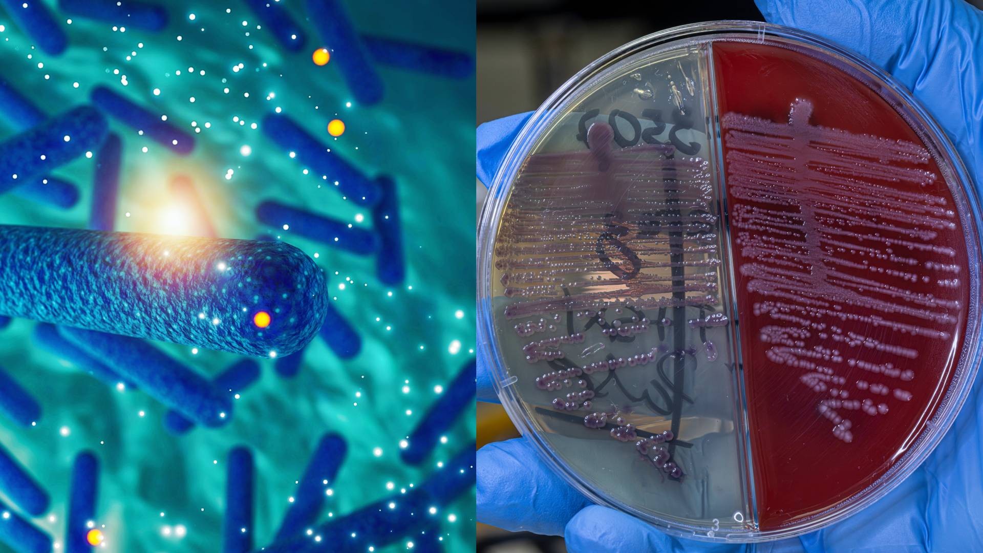 Surto na PB: pizza com bactérias comuns causa morte e mais de 100 casos de intoxicação alimentar; saiba como se proteger