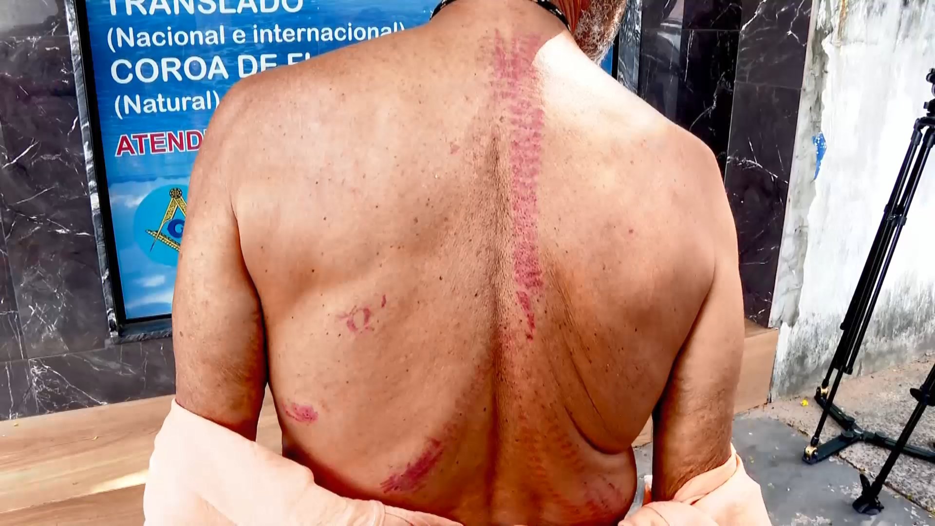 Argentino reage a assalto dentro da própria casa e é espancado na Serra