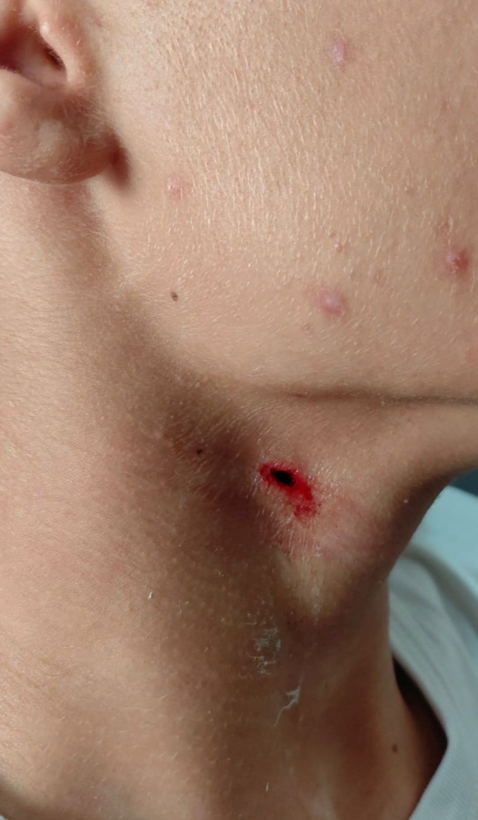 Adolescente foi atacado com golpe de caneta — Foto: Polícia Civil