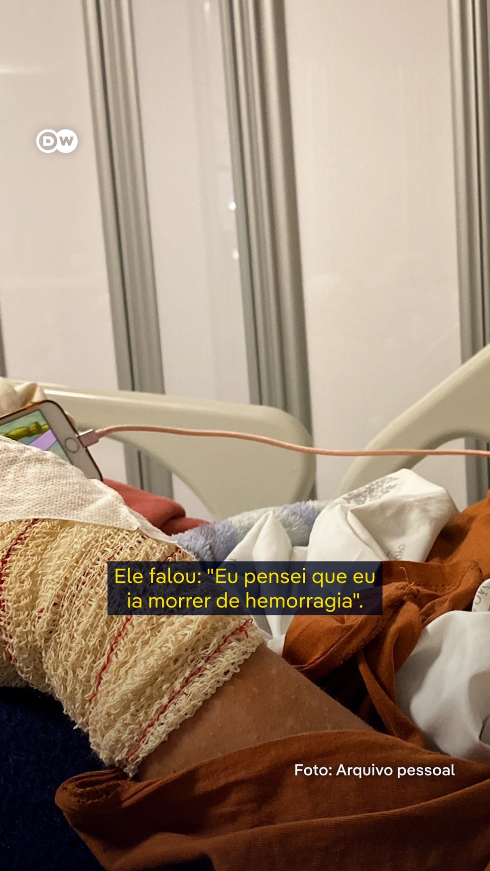 Menino brasileiro de 9 anos teve pedaços de dois dedos decepados — Foto: Deutsche Welle