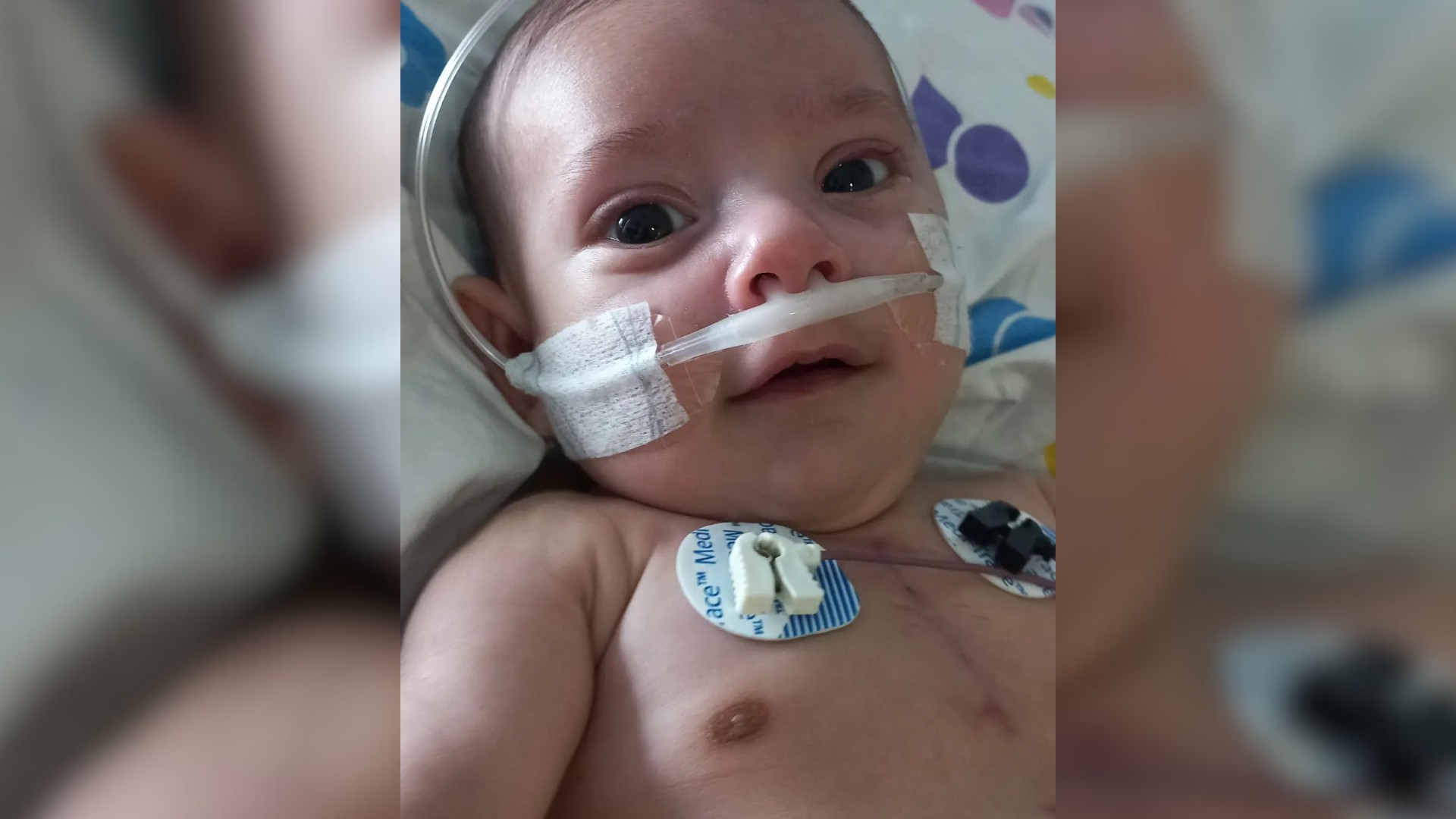 Família de menino que nasceu com 'meio coração' relata preocupação com custos médicos após realização de cirurgias