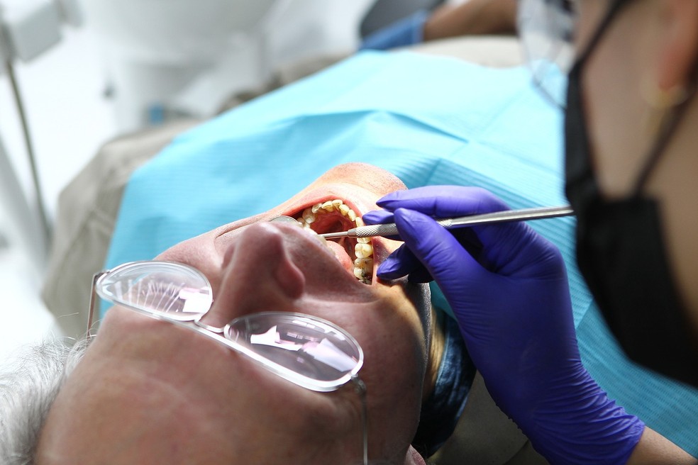 Sade bucal: perpetua-se no Brasil a prtica clnica voltada  lgica curativa e no  preventiva, afirma o professor Gustavo G. Nascimento  Foto: Diegotoralabad para Pixabay