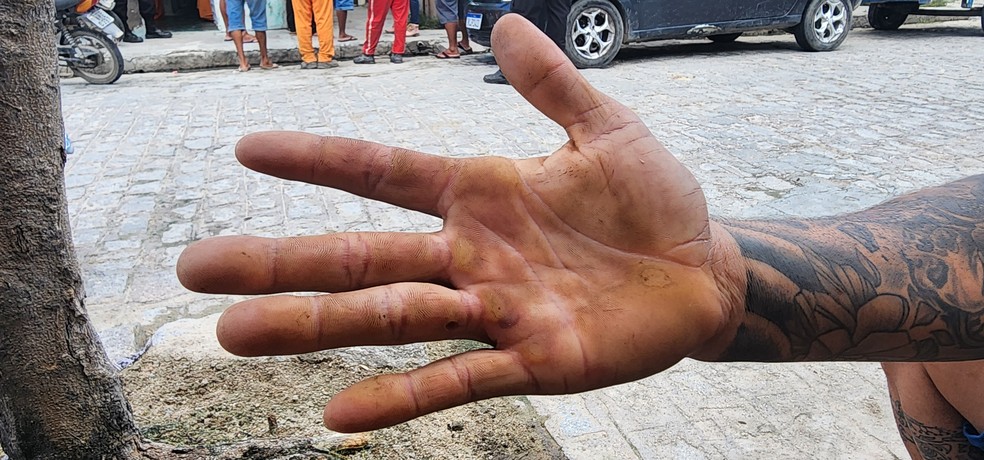 Trabalhador resgatado em condições análogas à escravidão em pedreira em Ouro Branco, AL, mostra mão machucada do serviço desempenhado sem EPIs — Foto: GEFM/MTE