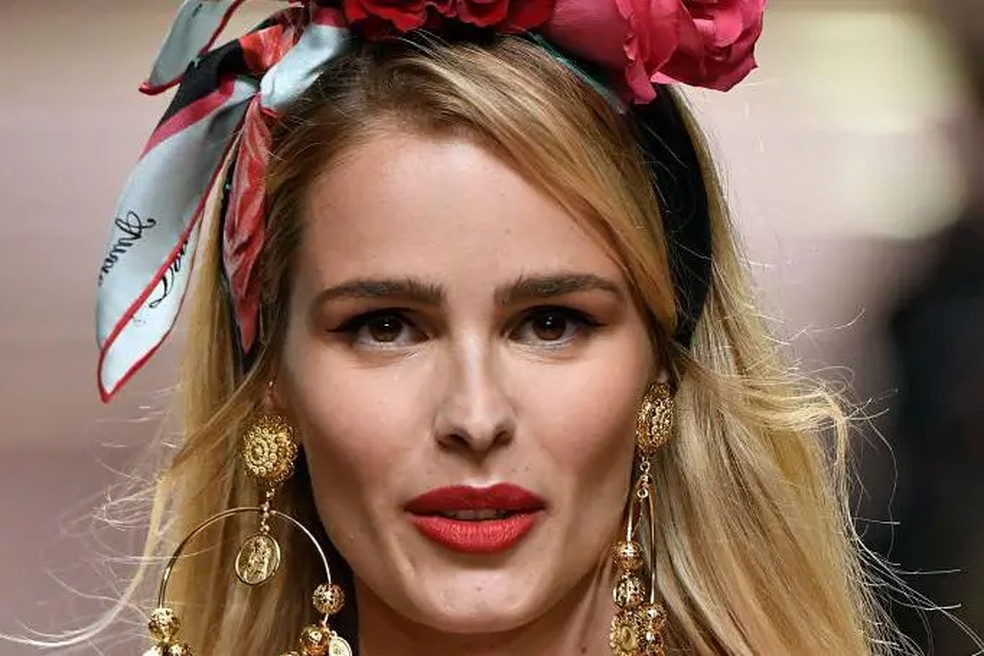 A modelo Yasmin Brunet falou abertamente sobre seu diagnóstico de lipedema — Foto: GETTY IMAGES