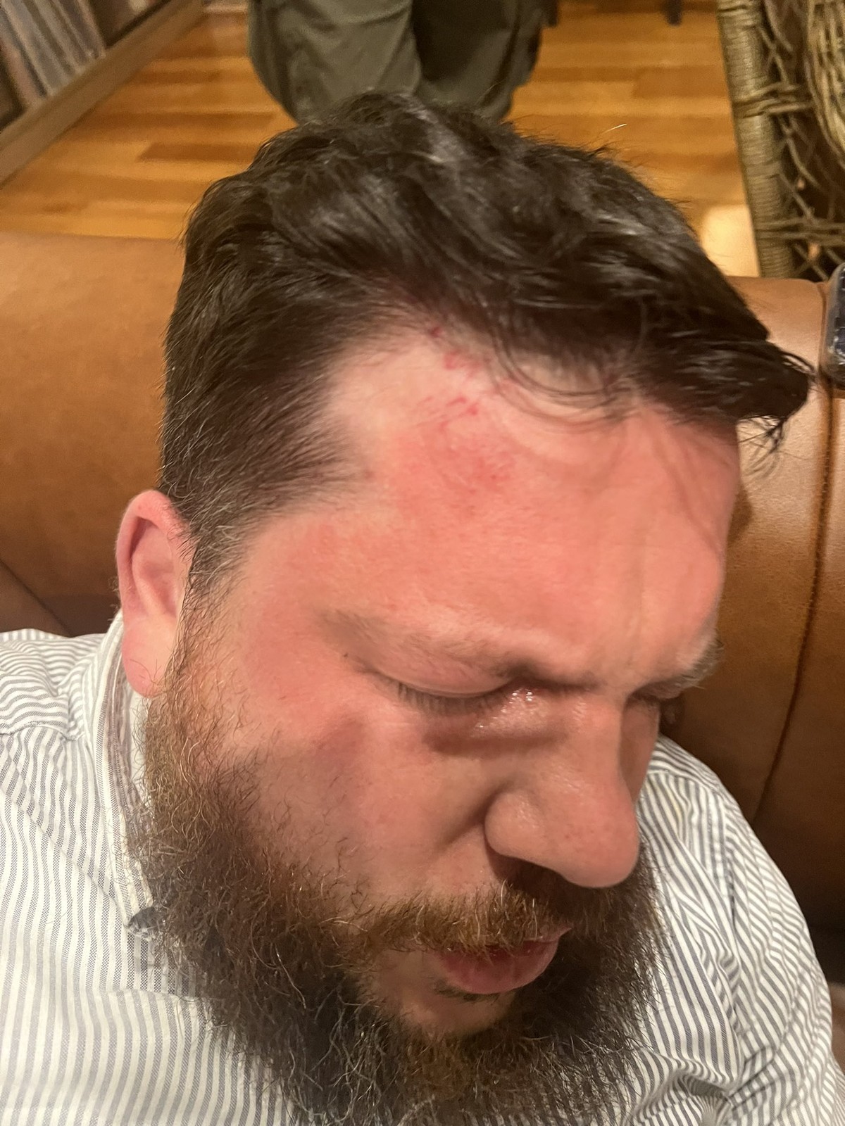 Opositor russo Leonid Volkov, aliado de Navalny, é agredido com martelo em frente à sua casa