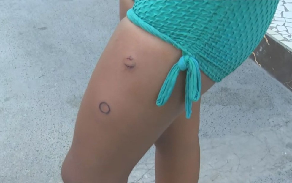 Mulher foi ferida por bala de borracha — Foto: TV Bahia