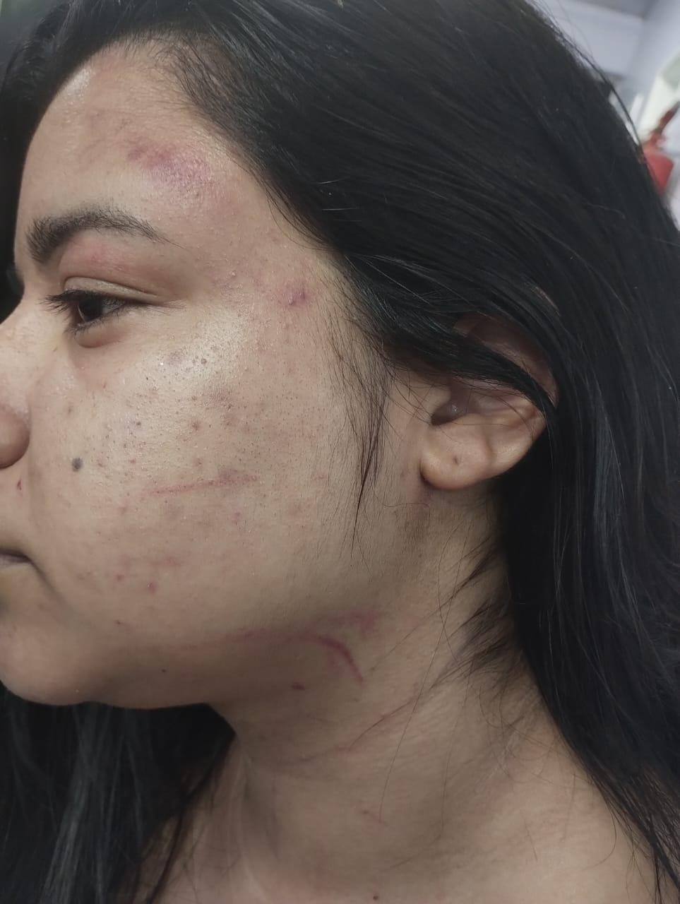 Jovem denuncia namorado, sogra e cunhada por agressões na frente da filha de 7 anos em Manaus