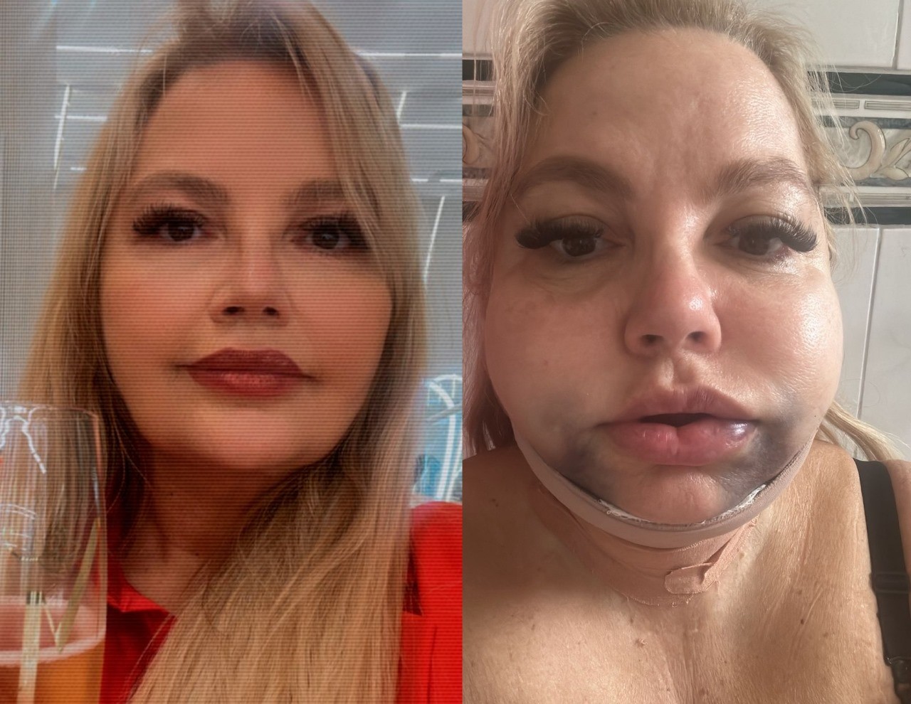 Justiça do Rio determina uso de tornozeleira a dentista ré por lesão corporal após descumprir ordem judicial e tentar deixar o país