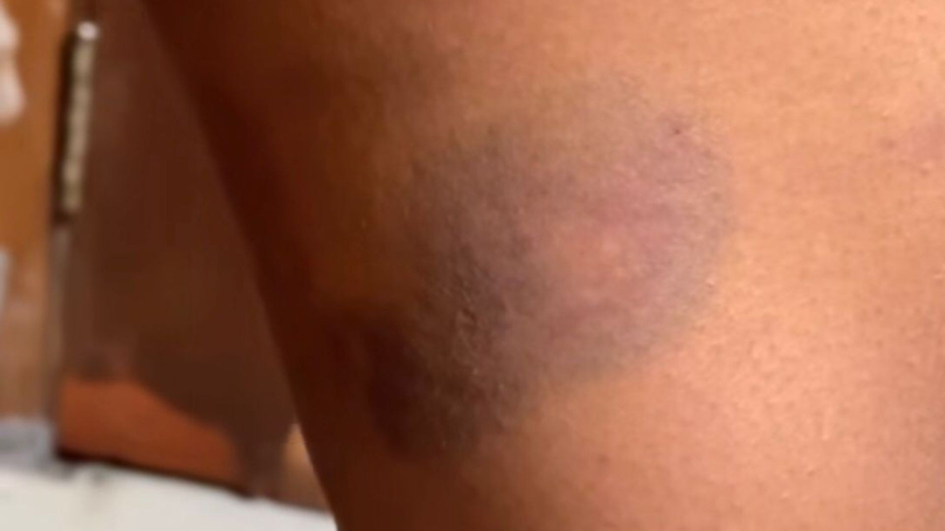 
Mulher é resgatada em Uberlândia após dois dias trancada em casa sob agressões e ameaças do companheiro