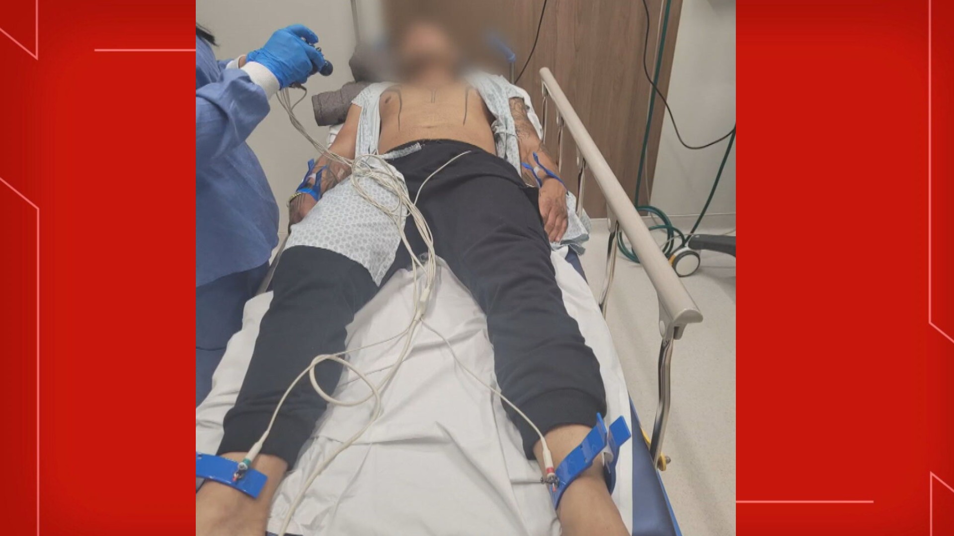 FOTOS: PM que denunciou tortura de colegas teve hematomas pelo corpo; ele relata dificuldades para andar e enxergar 
