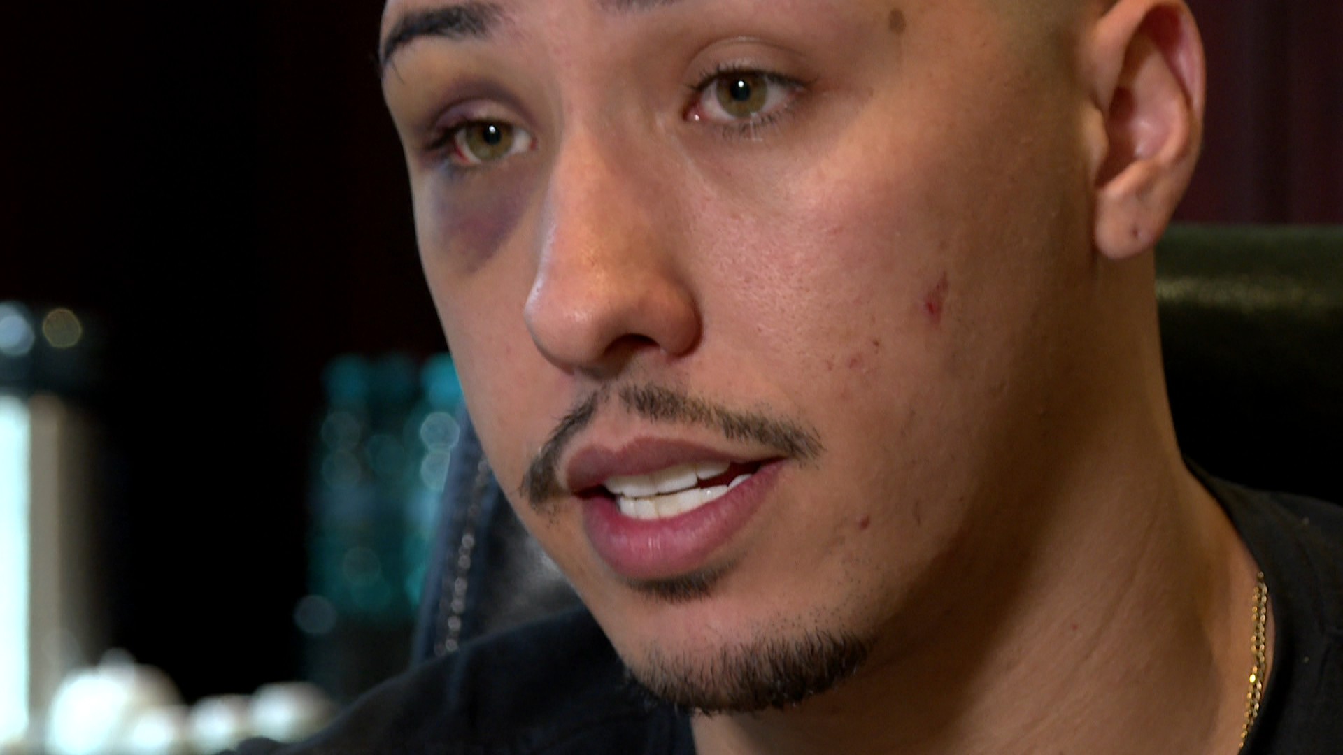 Manobrista filmado trocando socos com deputado em Curitiba diz que não sabia quem ele era: 'Fui saber só depois'