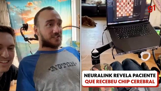 VÍDEO: paciente que recebeu 1º implante da Neuralink mostra como chip cerebral funciona - Programa: G1 Mundo 