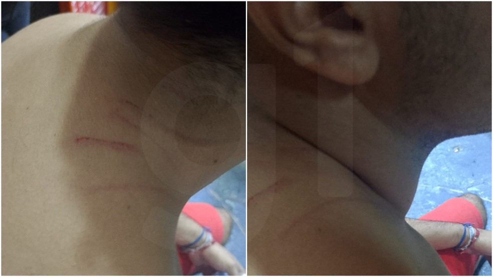 Homem com autismo ficou com um corte na boca e arranhões pelo corpo após ser atacado por grupo. — Foto: TV Verdes Mares/Reprodução