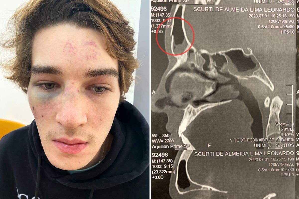 Estudante Espancado Por Seguran a Ap s Ser Levado Para salinha Em