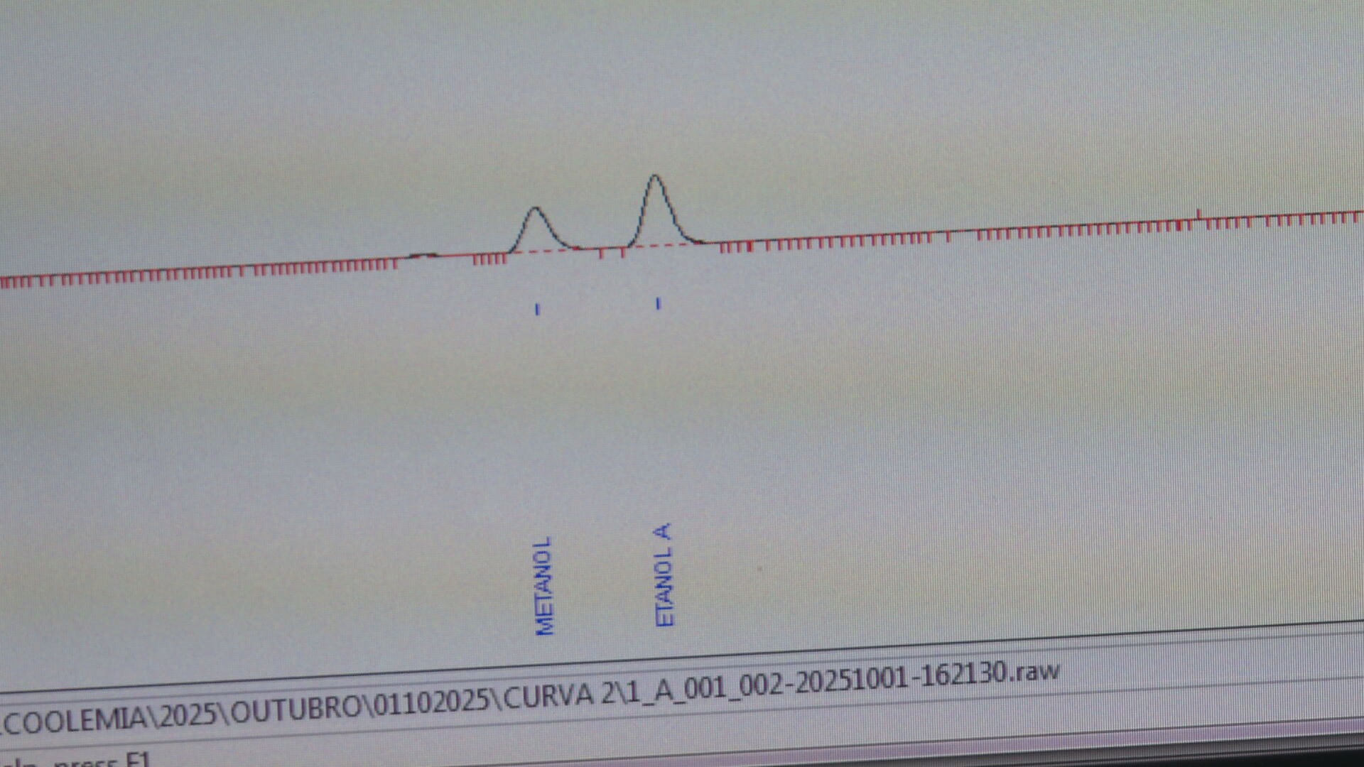 Metanol: peritos explicam como é feita identificação de substância em bebidas e no corpo das vítimas