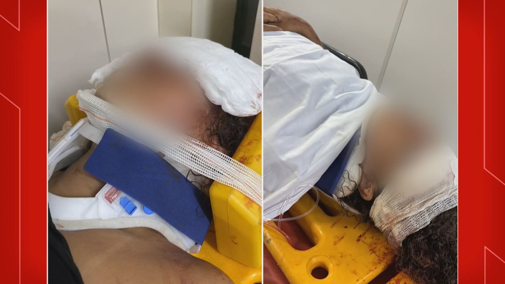 Motorista atropela jovem no DF após ela recusar convite de homens que estavam no carro