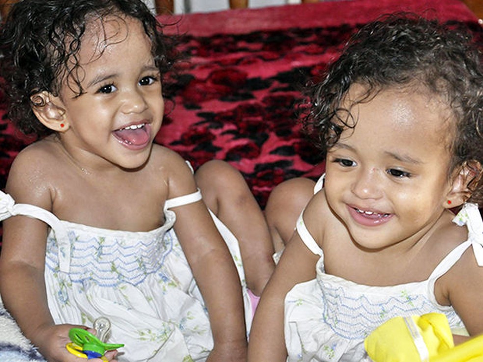 Siamesas de MT — Foto: Kelly Martins/G1