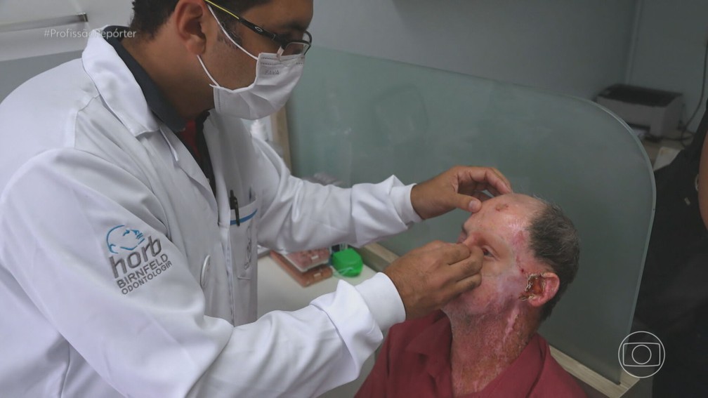 Seu Breno trata um câncer de pele há 20 anos — Foto: Reprodução/TV Globo