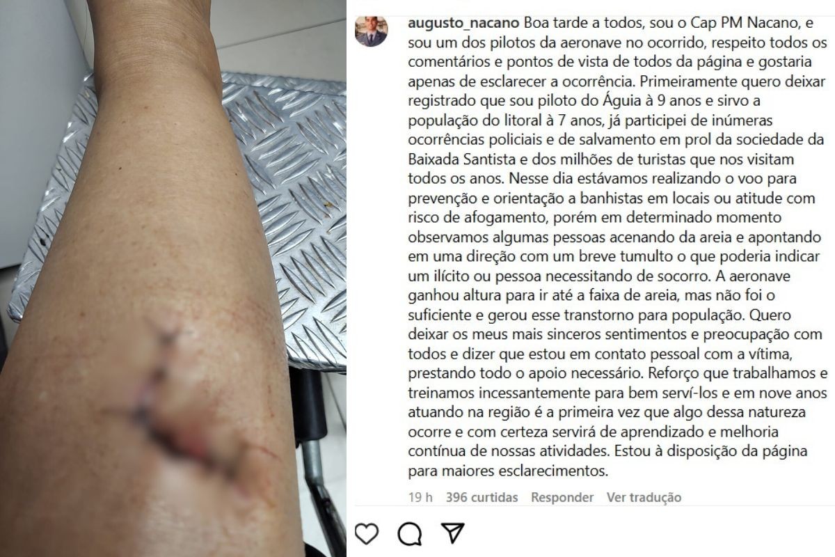 Piloto da PM pede desculpas após sobrevoar praia e causar lesão em turista 