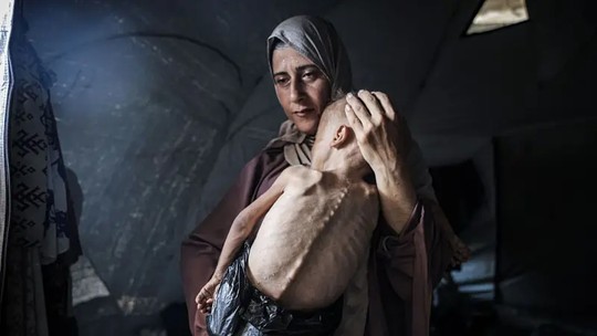 A história por trás da chocante foto do bebê faminto de Gaza