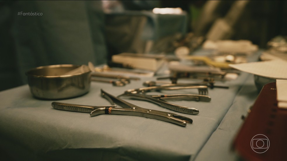 73% dos cirurgiões dizem que já operaram algum paciente para retirada de um corpo estranho, aponta levantamento da USP — Foto: Fantástico/ Reprodução