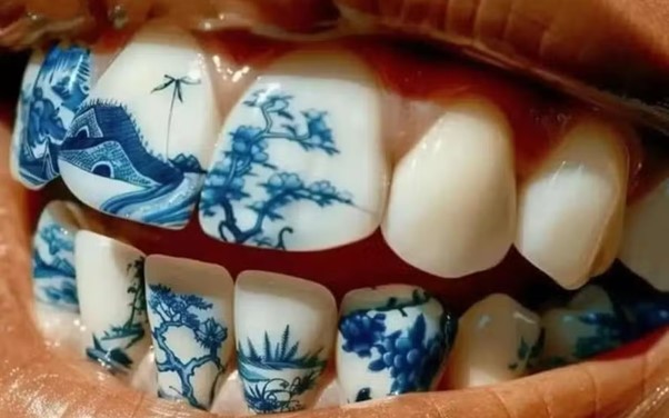 Tatuagem nos dentes: Especialista comenta a tendência e seus riscos