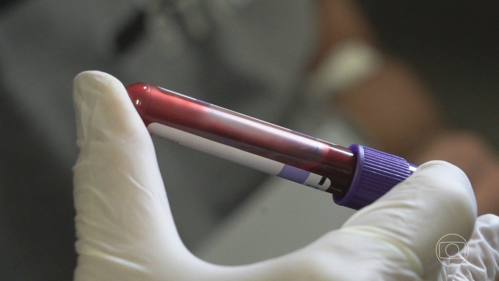 No RJ, 6 pessoas que receberam órgãos transplantados contraíram HIV;  laboratório tinha emitido atestados de segurança dos órgãos | Jornal  Nacional | G1
