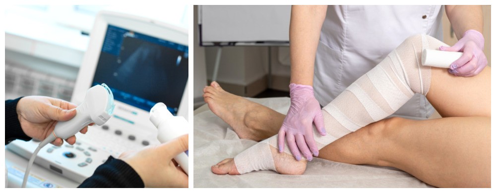 Novo estudo define critérios para diagnóstico por imagem do lipedema, que aflige 12% das brasileiras