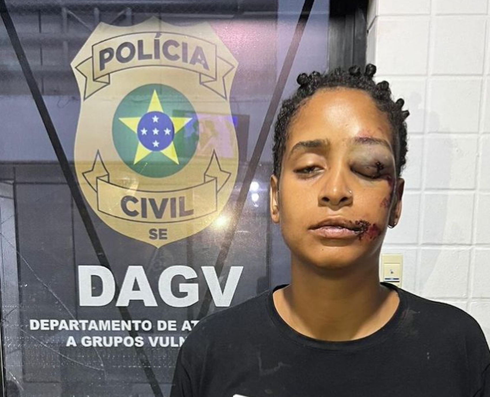 Mulher tem rosto desfigurado durante confusão em lanchonete em Aracaju e denuncia homofobia