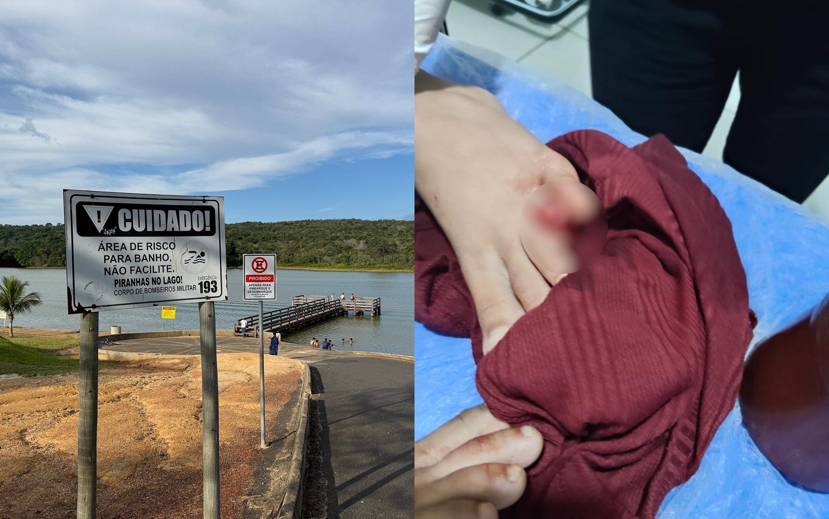 Criança é atacada por piranhas em lago de Caldas Novas