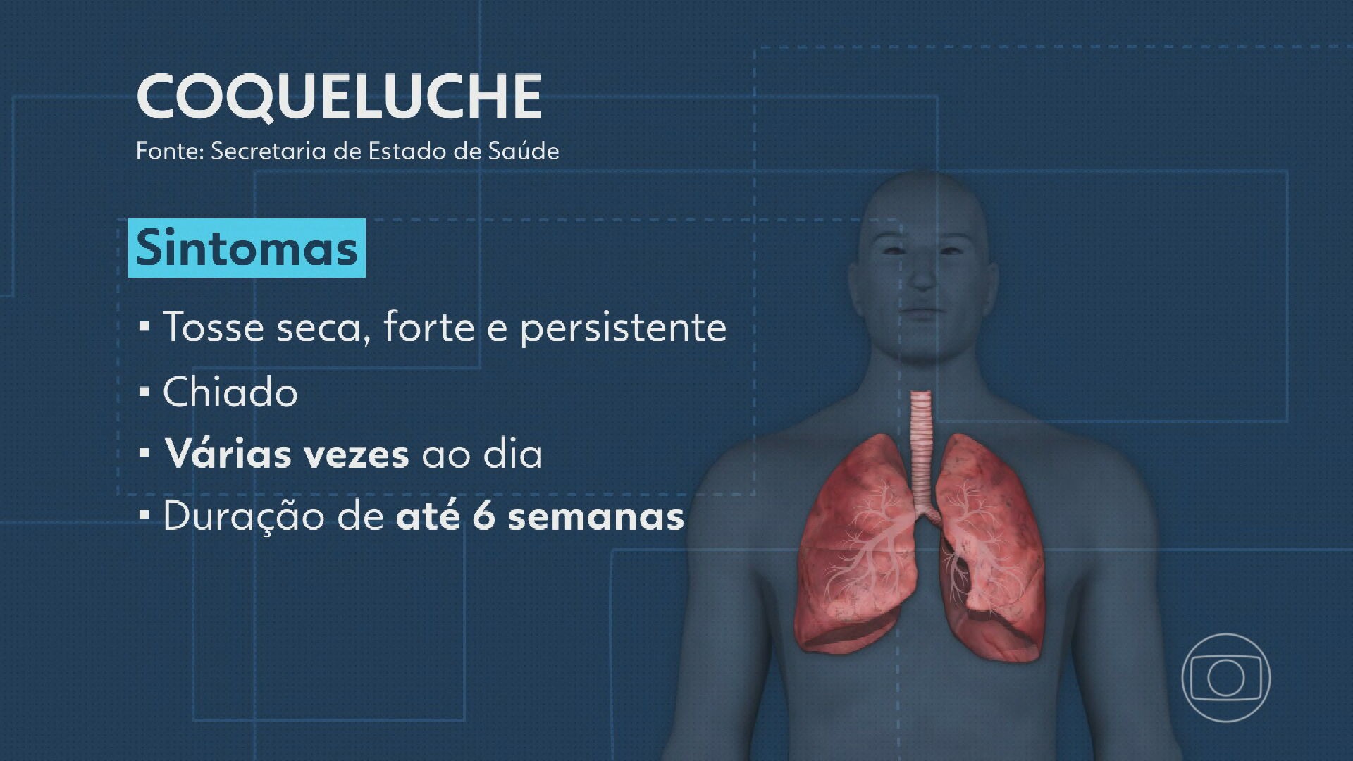 Após 2 anos sem registros, RJ contabiliza 230 casos de coqueluche em 2024; três bebês morreram