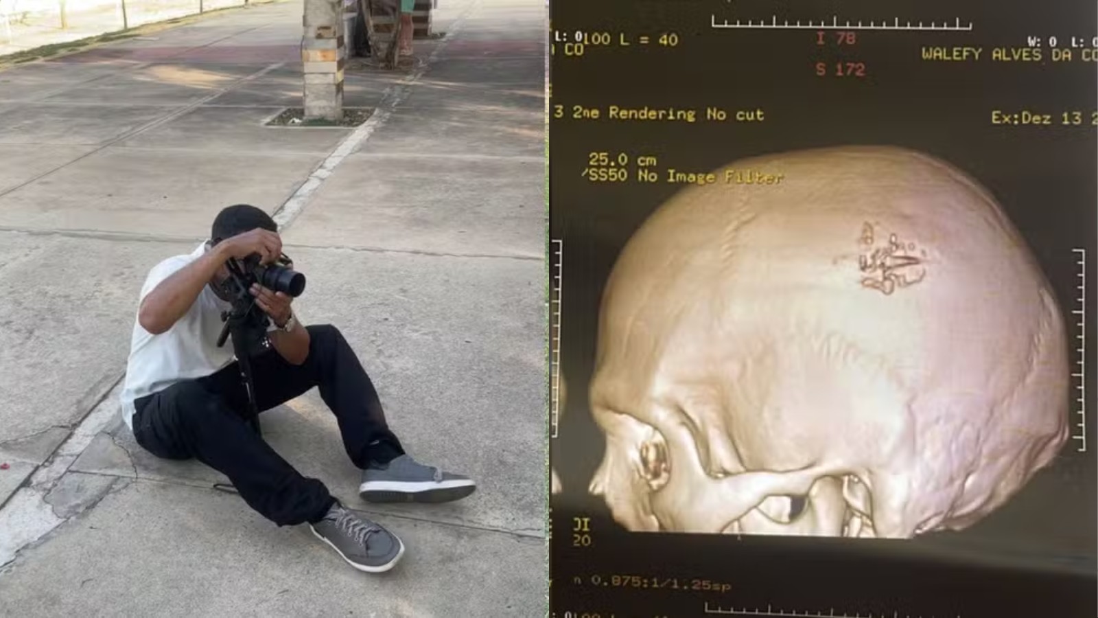 Fotógrafo que sobreviveu a tiro na cabeça supera sequelas e faz ensaios em parque de Teresina: 'mais de 2 meses sem conseguir falar'